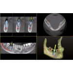 *I-Max 3D Nueva Generación